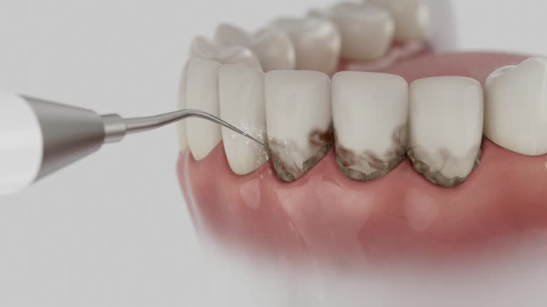 Trusted Tooth Extraction service in Anna, OH - Dentist Open Now